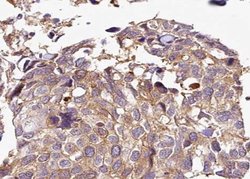 Invitrogen Phospho-HDAC5 (Ser498) Polyclonal Antibody 100 &mu;L; Unconjugated:Antibodies,