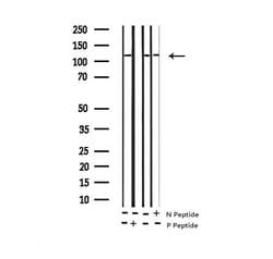 Invitrogen Phospho-HDAC5 (Ser498) Polyclonal Antibody 100 &mu;L; Unconjugated:Antibodies,