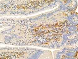 Invitrogen Phospho-CaMKII alpha/delta (Thr286) Polyclonal Antibody 100