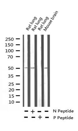 Invitrogen Phospho-CaMKII alpha/delta (Thr286) Polyclonal Antibody 100