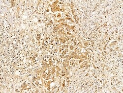 Invitrogen CASPASE 1 P10 (CLEAVED ALA317) Polyclonal Antibody 100 &mu;L;