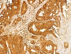 Invitrogen CASPASE 1 P10 (CLEAVED ALA317) Polyclonal Antibody 100 &mu;L;