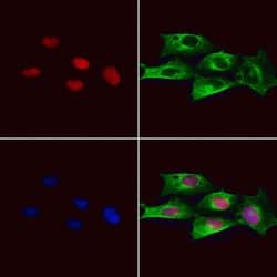 Invitrogen CASPASE 1 P10 (CLEAVED ALA317) Polyclonal Antibody 100 &mu;L;
