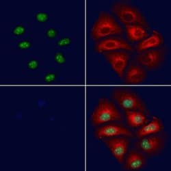 Invitrogen CASPASE 1 P10 (CLEAVED ALA317) Polyclonal Antibody 100 &mu;L;