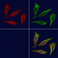 Invitrogen Phospho-ROCK1 (Tyr913) Polyclonal Antibody 100 μL; Unconjugated:Antibodies,