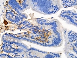 Invitrogen Phospho-ROCK1 (Tyr913) Polyclonal Antibody 100 μL; Unconjugated:Antibodies,