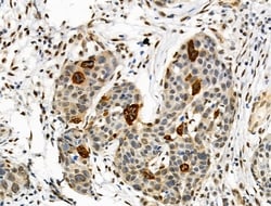 Invitrogen Phospho-TSC1 (Ser505) Polyclonal Antibody 100 &mu;L; Unconjugated:Antibodies,
