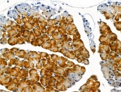 Invitrogen Phospho-TSC1 (Ser505) Polyclonal Antibody 100 &mu;L; Unconjugated:Antibodies,