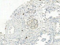 Invitrogen Phospho-NLRP3 (Ser295) Polyclonal Antibody 100 &mu;L; Unconjugated:Antibodies,