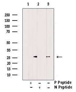 Invitrogen Phospho-PPP1R8 (Ser199) Polyclonal Antibody 100 &mu;L | Buy Online | Invitrogen&trade; | Fisher Scientific