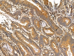 Invitrogen Phospho-NEDD4 (Ser670) Polyclonal Antibody 100 &mu;L; Unconjugated:Antibodies,