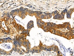 Invitrogen Phospho-NEDD4 (Ser670) Polyclonal Antibody 100 &mu;L; Unconjugated:Antibodies,