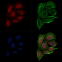 Invitrogen Phospho-PABPN1 (Ser150) Polyclonal Antibody 100 &mu;L; Unconjugated:Antibodies,