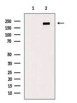 Invitrogen Phospho-LRP5 (Tyr1473) Polyclonal Antibody 100 &mu;L | Buy Online | Invitrogen&trade; | Fisher Scientific