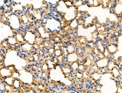 Phospho-CD32 (Tyr288) Polyclonal Antibody, Invitrogen 100 &mu;L; Unconjugated:Antibodies,
