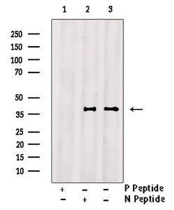 Phospho-CD32 (Tyr288) Polyclonal Antibody, Invitrogen 100 &mu;L; Unconjugated:Antibodies,