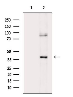 Invitrogen Phospho-CD79b (Tyr207) Polyclonal Antibody 100 &mu;L; Unconjugated:Antibodies,