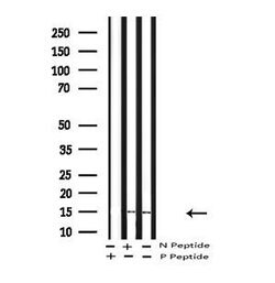 Invitrogen Phospho-LC3B (Thr29) Polyclonal Antibody 100 &mu;L | Buy Online | Invitrogen&trade; | Fisher Scientific