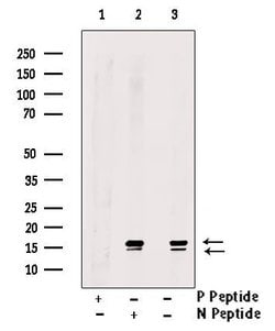 Invitrogen Phospho-LC3B (Thr29) Polyclonal Antibody 100 &mu;L | Buy Online | Invitrogen&trade; | Fisher Scientific