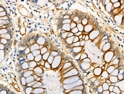 Invitrogen Acetyl-alpha Tubulin (Lys40) Polyclonal Antibody 100 &mu;L;