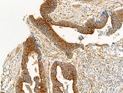 Invitrogen Acetyl-alpha Tubulin (Lys40) Polyclonal Antibody 100 &mu;L;