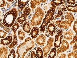 Invitrogen Acetyl-alpha Tubulin (Lys40) Polyclonal Antibody 100 &mu;L;