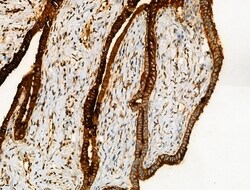 Invitrogen Acetyl-alpha Tubulin (Lys40) Polyclonal Antibody 100 &mu;L;