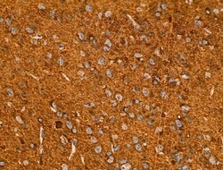 Invitrogen Acetyl-alpha Tubulin (Lys40) Polyclonal Antibody 100 &mu;L;