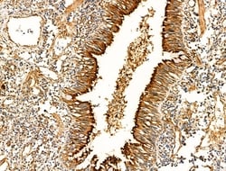 Invitrogen Acetyl-alpha Tubulin (Lys40) Polyclonal Antibody 100 &mu;L;
