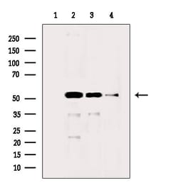 Invitrogen Acetyl-alpha Tubulin (Lys40) Polyclonal Antibody 100 &mu;L;