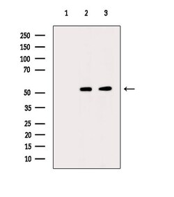 Invitrogen Acetyl-alpha Tubulin (Lys40) Polyclonal Antibody 100 &mu;L;