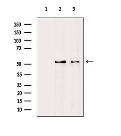 Invitrogen Acetyl-alpha Tubulin (Lys40) Polyclonal Antibody 100 &mu;L;