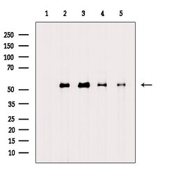 Invitrogen Acetyl-alpha Tubulin (Lys40) Polyclonal Antibody 100 &mu;L;