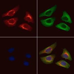 Invitrogen Acetyl-alpha Tubulin (Lys40) Polyclonal Antibody 100 &mu;L;