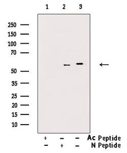 Invitrogen Acetyl-alpha Tubulin (Lys40) Polyclonal Antibody 100 &mu;L;