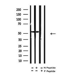 Invitrogen Acetyl-alpha Tubulin (Lys40) Polyclonal Antibody 100 &mu;L;