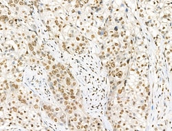 Invitrogen Phospho-Histone H4 (Tyr89) Polyclonal Antibody 100 &mu;L; Unconjugated:Antibodies,