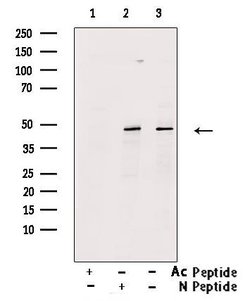 Invitrogen Acetyl-p53 (Lys373) Polyclonal Antibody 100 &mu;L; Unconjugated:Antibodies,