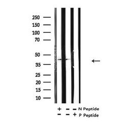Invitrogen Acetyl-p53 (Lys373) Polyclonal Antibody 100 &mu;L; Unconjugated:Antibodies,