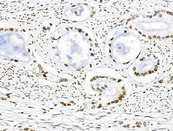 Invitrogen Acetyl-p53 (Lys373) Polyclonal Antibody 100 &mu;L; Unconjugated:Antibodies,