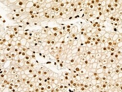 Invitrogen Acetyl-p53 (Lys373) Polyclonal Antibody 100 &mu;L; Unconjugated:Antibodies,