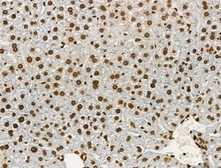 Invitrogen Acetyl-p53 (Lys373) Polyclonal Antibody 100 &mu;L; Unconjugated:Antibodies,