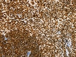 Invitrogen Acetyl-p53 (Lys373) Polyclonal Antibody 100 &mu;L; Unconjugated:Antibodies,