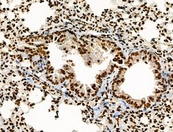 Invitrogen Acetyl-p53 (Lys373) Polyclonal Antibody 100 &mu;L; Unconjugated:Antibodies,