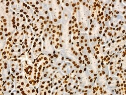 Invitrogen Acetyl-p53 (Lys373) Polyclonal Antibody 100 &mu;L; Unconjugated:Antibodies,