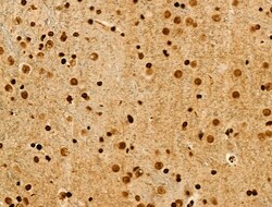 Invitrogen Acetyl-p53 (Lys373) Polyclonal Antibody 100 &mu;L; Unconjugated:Antibodies,