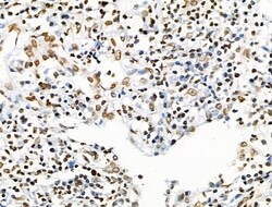 Invitrogen Acetyl-p53 (Lys373) Polyclonal Antibody 100 &mu;L; Unconjugated:Antibodies,