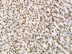 Invitrogen Acetyl-p53 (Lys373) Polyclonal Antibody 100 &mu;L; Unconjugated:Antibodies,
