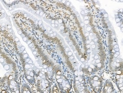 Invitrogen Acetyl-p53 (Lys373) Polyclonal Antibody 100 &mu;L; Unconjugated:Antibodies,