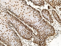 Invitrogen Acetyl-p53 (Lys373) Polyclonal Antibody 100 &mu;L; Unconjugated:Antibodies,